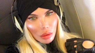 Rodrigo Alves fa coming out e decide di operarsi ai genitali: da Ken Umano diventerà Barbie