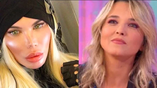 Rodrigo Alves: Francesca Barra perplessa dopo le operazioni. Lo sfogo dopo la puntata di Live