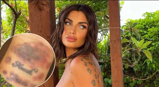 Elettra Lamborghini, polso tumefatto per la rimozione dei tatuaggi