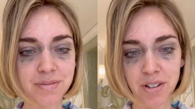 Chiara Ferragni si mostra sui social con occhiaie e trucco sbavato