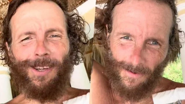 Jovanotti torna a parlare dopo l'incidente in bici