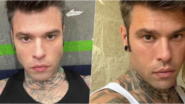 Fedez, parla il medico che l'ha operato un anno fa