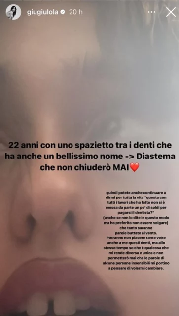 GIULIA STABILE ANCORA OFFESA PER I SUOI DENTI: LA RISPOSTA DA APPLAUSI