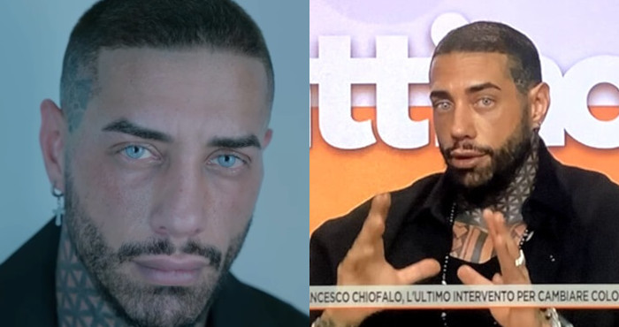 Francesco Chiofalo già pentito dell’operazione per cambiare il colore degli occhi? “Non sono più io”