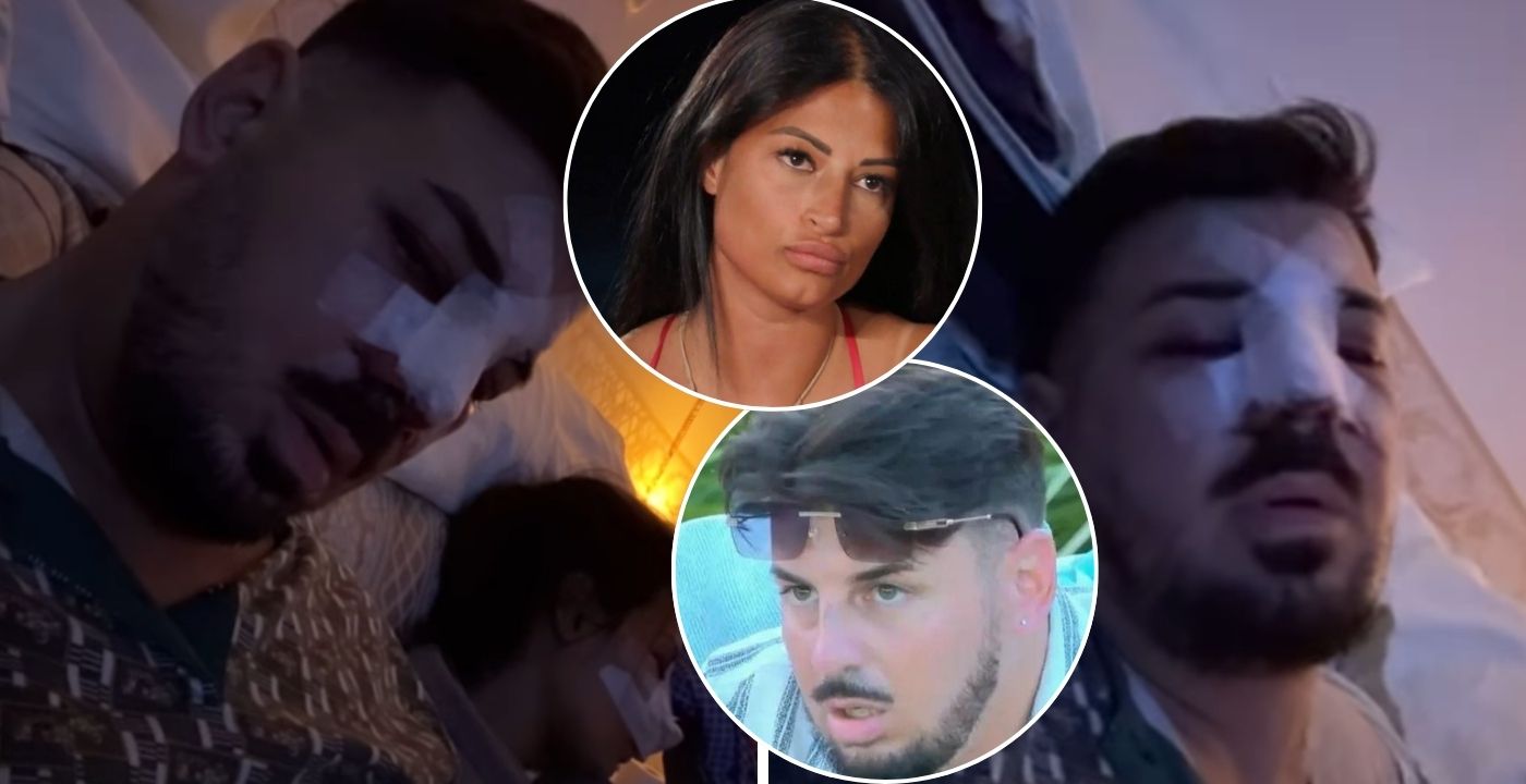 Lino Giuliano e Alessia Pascarella si operano insieme al naso (FOTO)